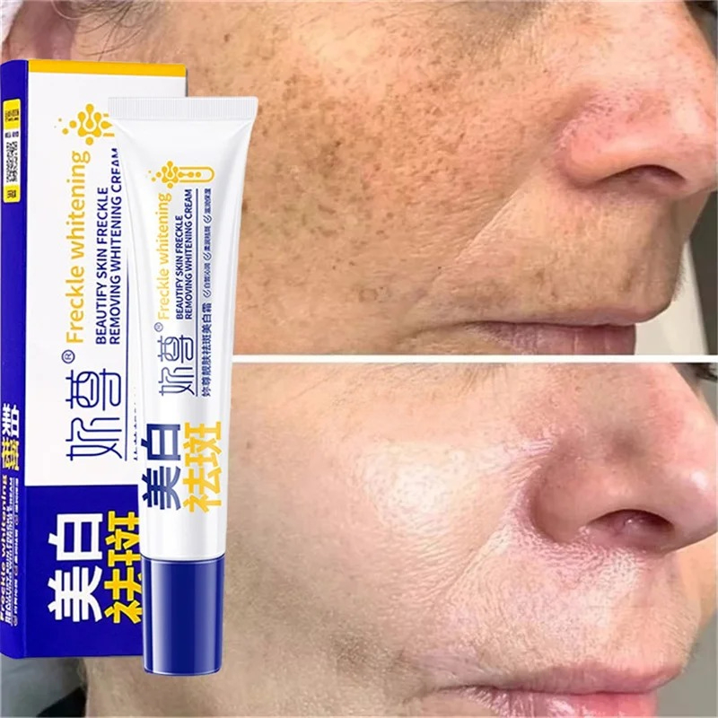 Crème blanchissante puissante  - Skincare Korea avis et prix