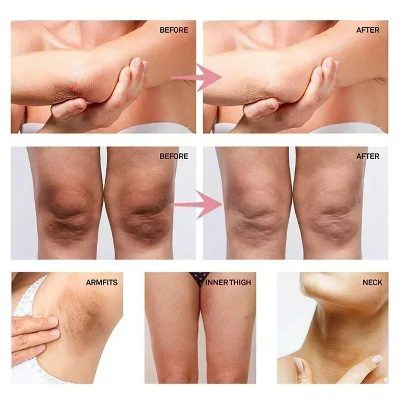 Crème éclaircissante pour les  - Skincare Whitening avis et prix
