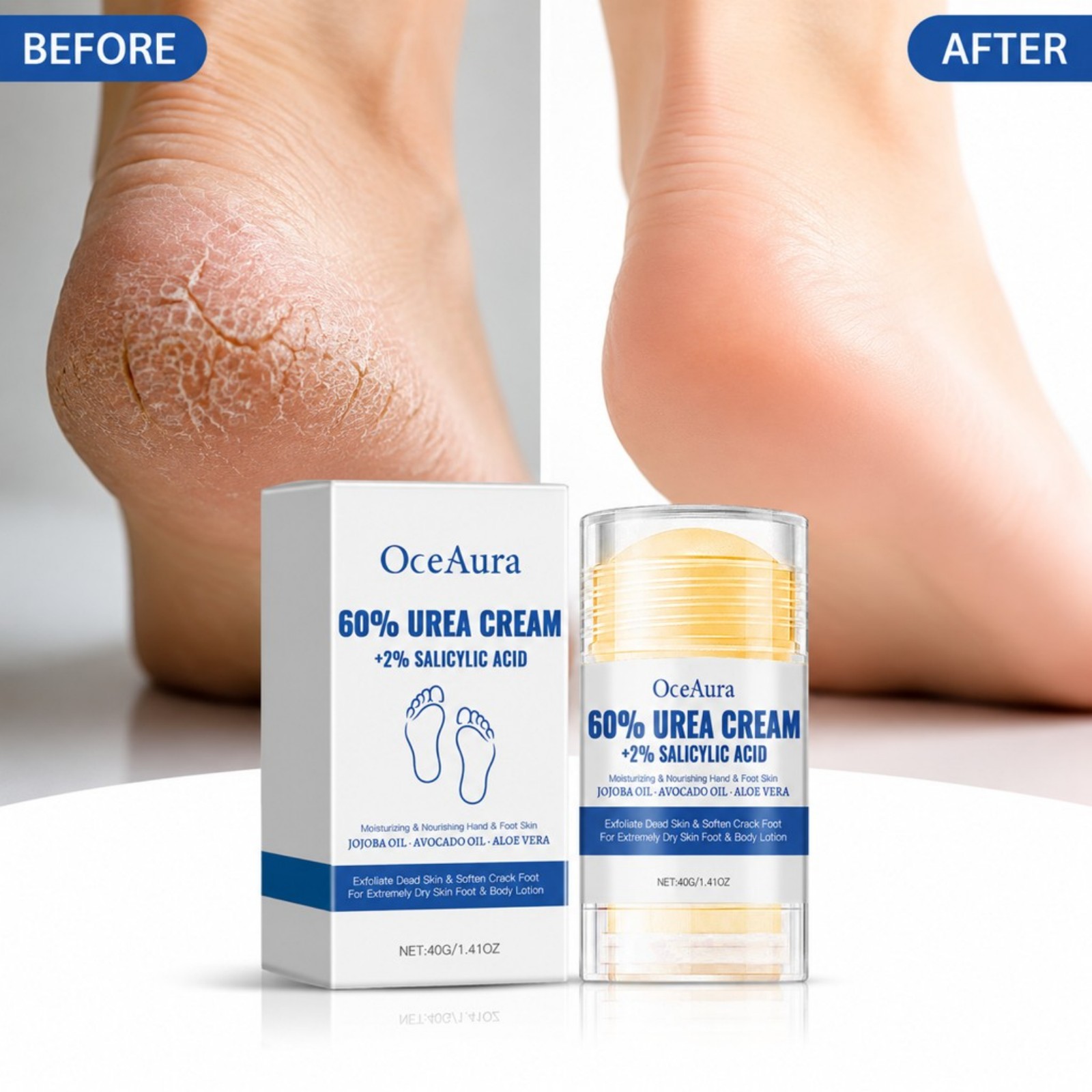 Crème pour les pieds à 60% d'u - Urea Foot Cream avis et prix