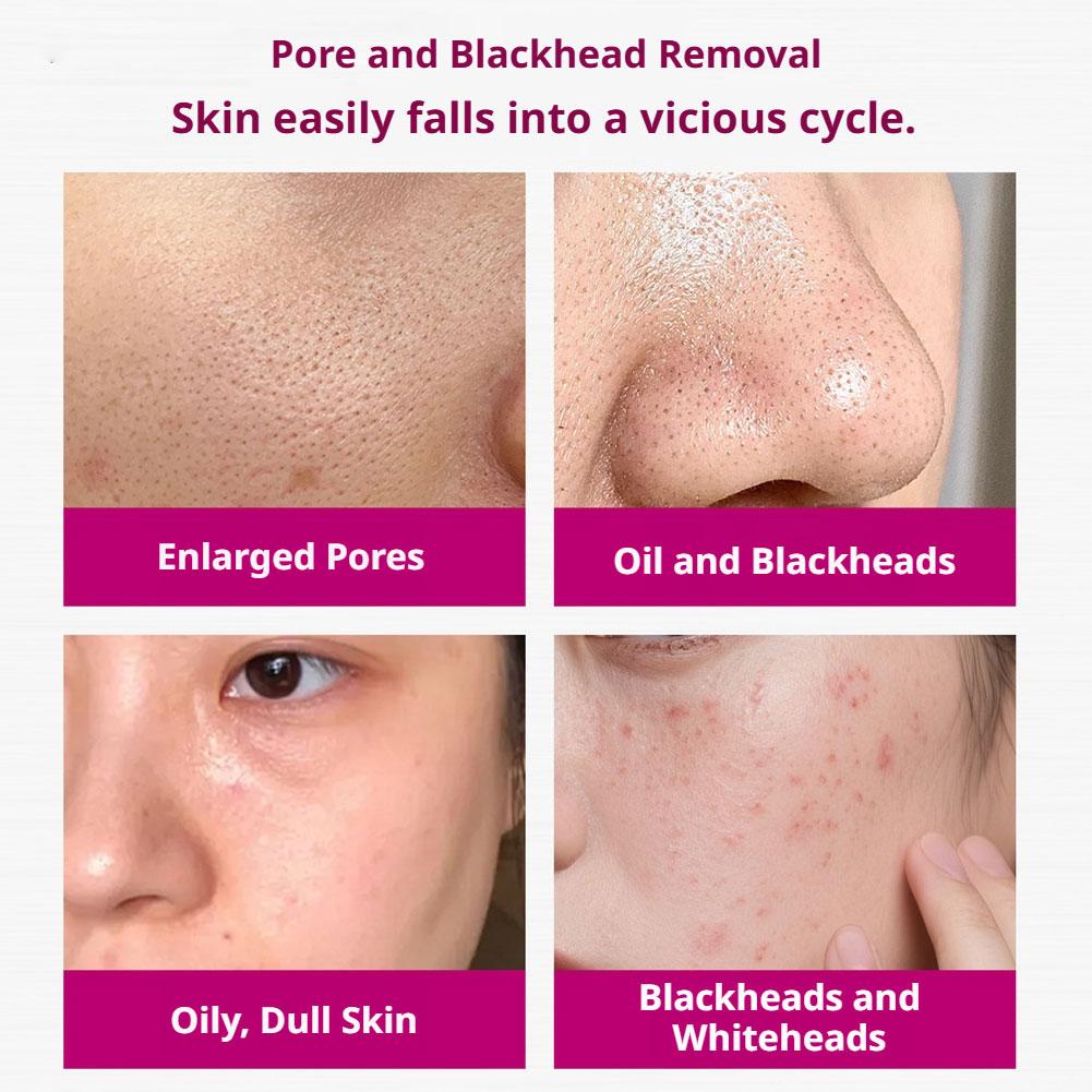 Sérum à l'acide salicylique po - Skincare Skintific avis et prix