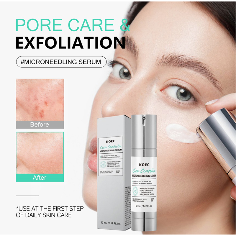 Sérum à micro-aiguilles Spicul - Skincare Centella avis et prix