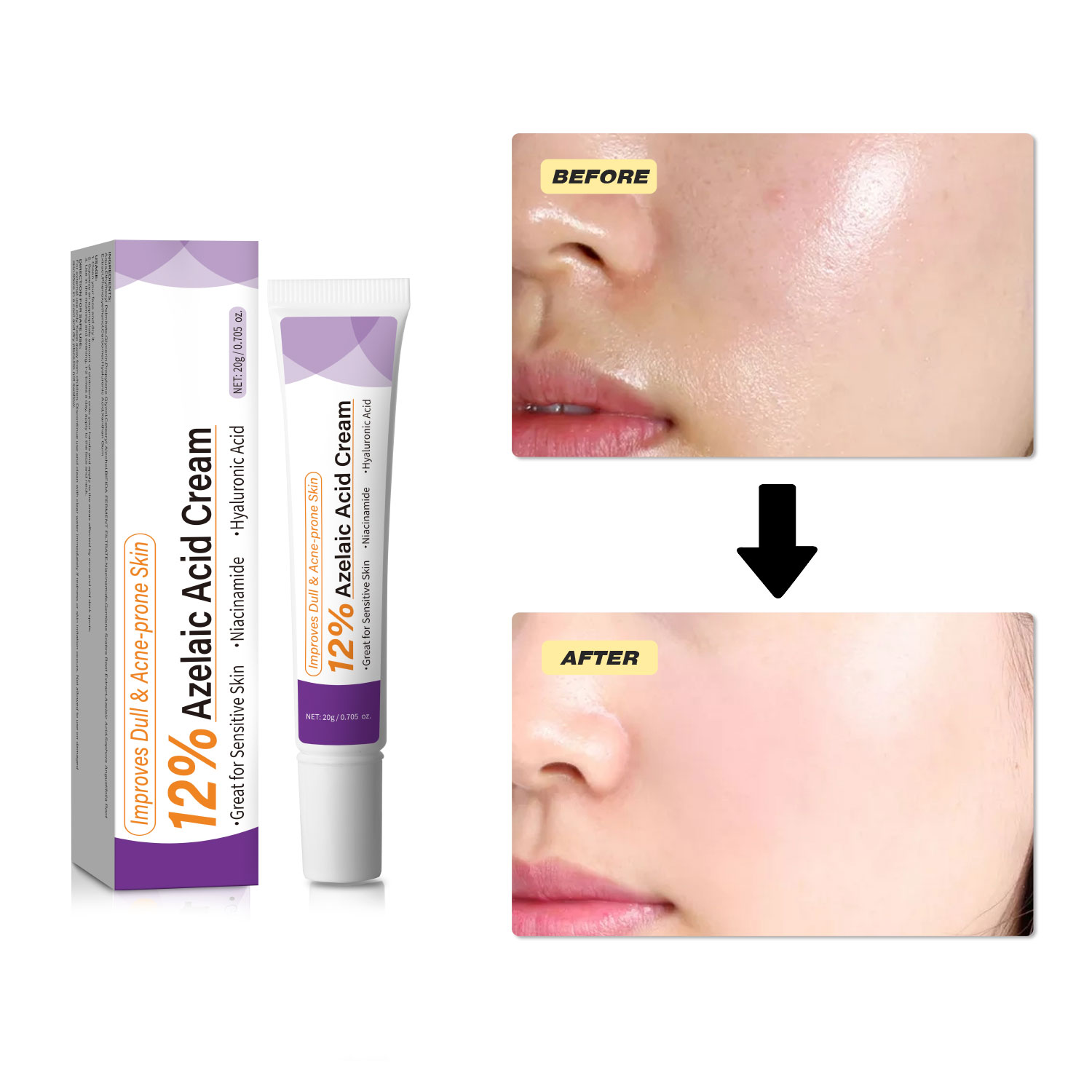 Crème à l'acide azélaïque douc - Skincare Skintific avis et prix